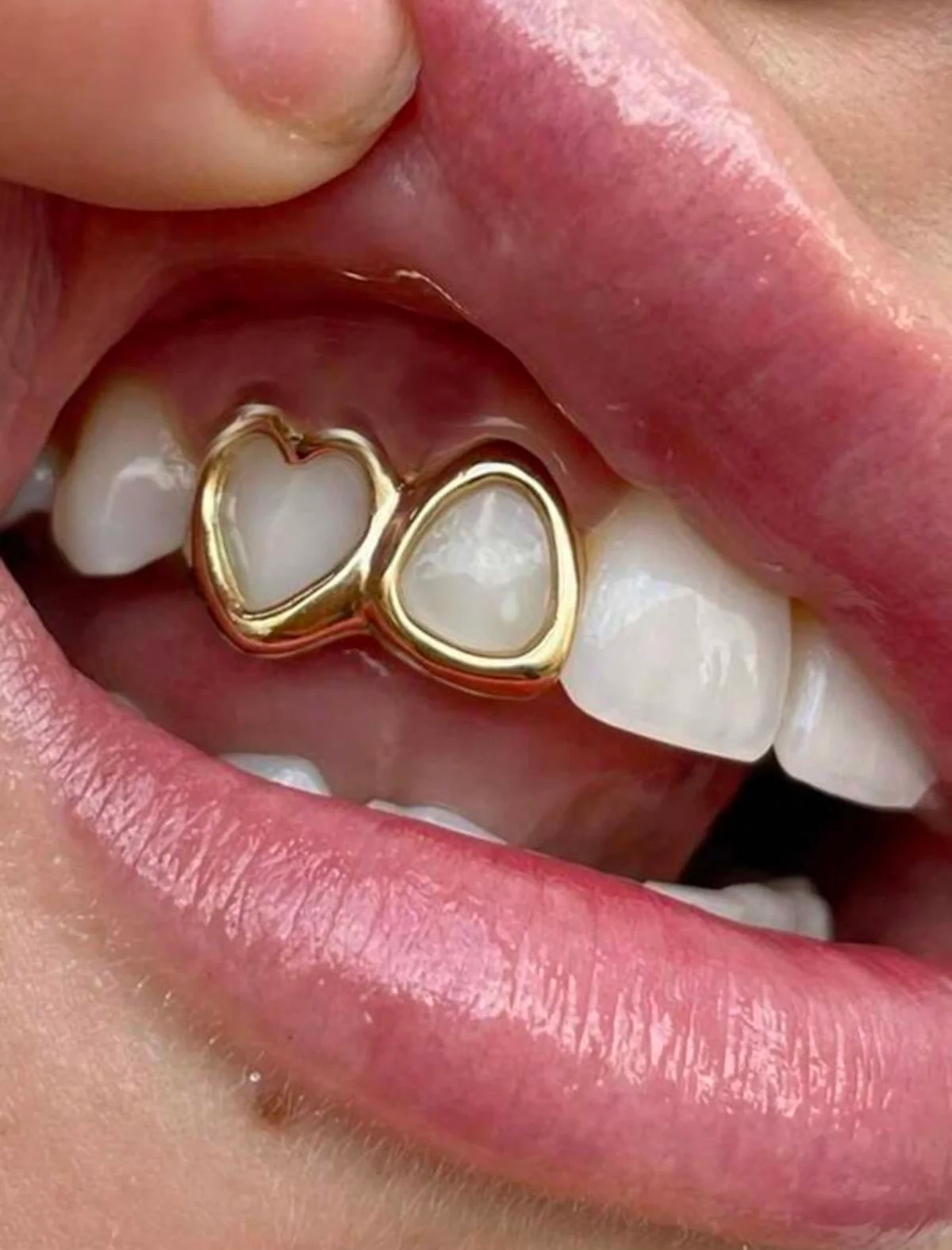 Golden Heart Star Tooth Gem - Image 0